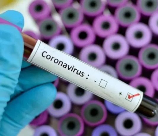 Coronavirus muestras análisis