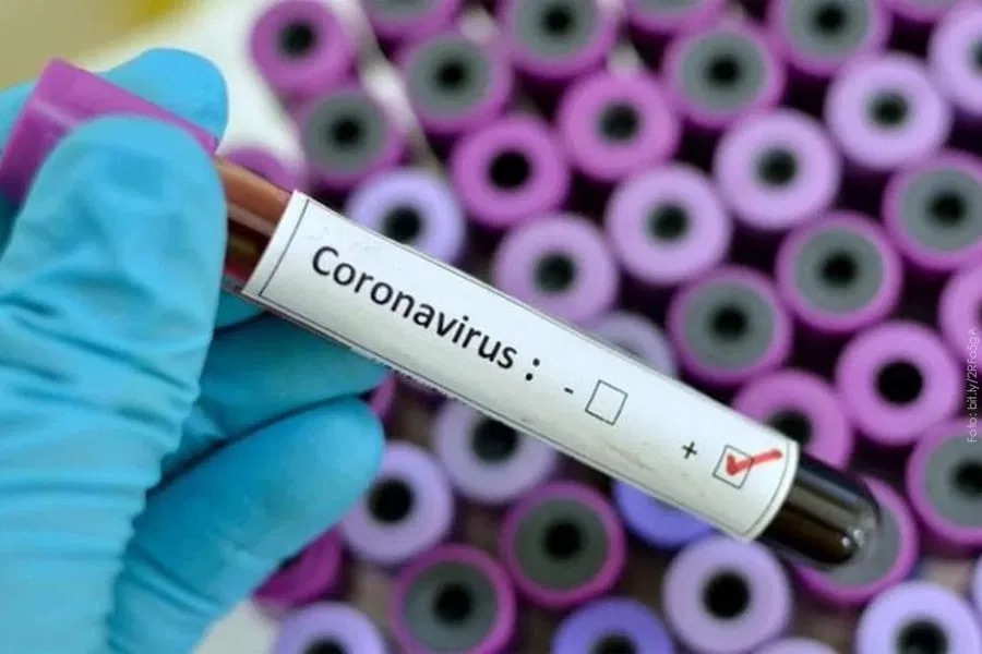 Coronavirus muestras análisis