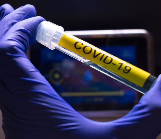 COVID-19 probeta