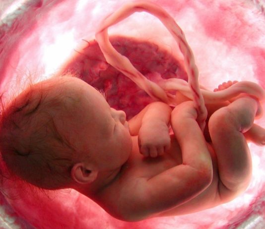 Placenta
