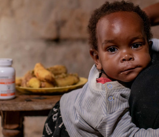 Lighton, de un año, recibe medicina pediátrica para el VIH todos los días en su casa en Mbarara, Uganda.