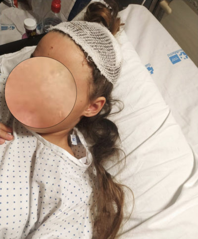 La niña agredida en meco se recupera en el hospital