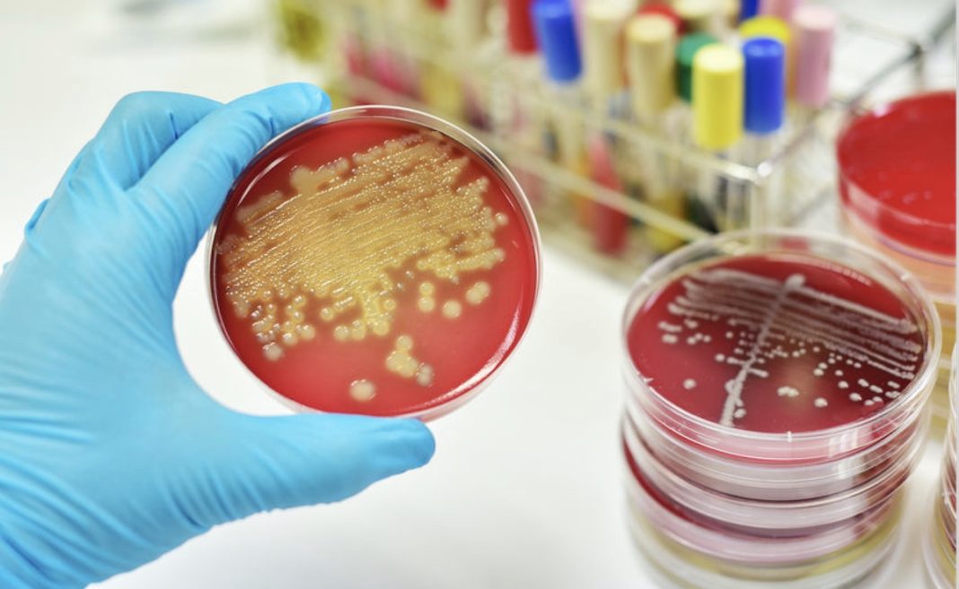 Bacterias en placa de Petri