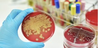 Bacterias en placa de Petri