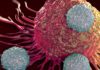 Europa acumula un cuarto de todos los casos de cáncer en el mundo