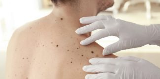 consultas dermatología crónicos