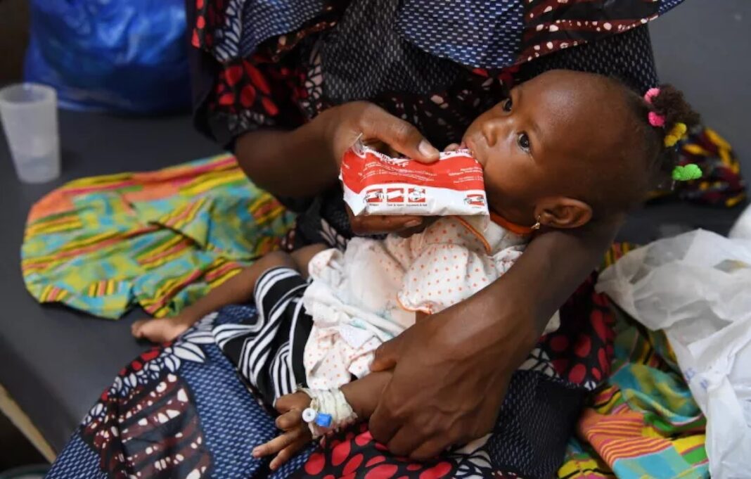 Mariam, de doce meses, recibe un tratamiento alimentario terapéutico en Burkina Faso, país que ha podido reducir la pobreza alimentaria infantil ©Dejongh / Unicef