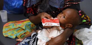 Mariam, de doce meses, recibe un tratamiento alimentario terapéutico en Burkina Faso, país que ha podido reducir la pobreza alimentaria infantil ©Dejongh / Unicef