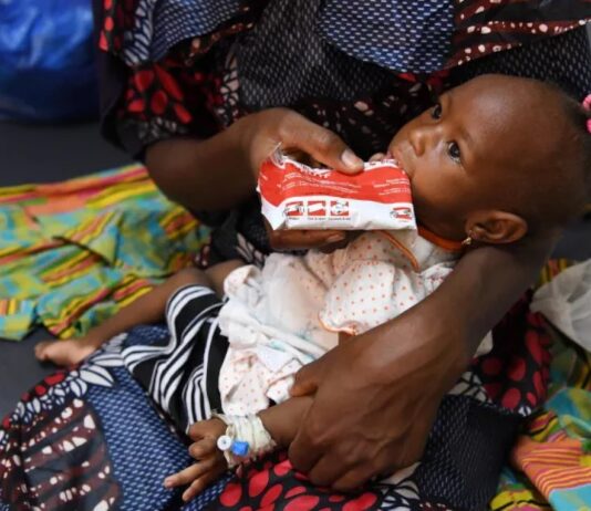 Mariam, de doce meses, recibe un tratamiento alimentario terapéutico en Burkina Faso, país que ha podido reducir la pobreza alimentaria infantil ©Dejongh / Unicef