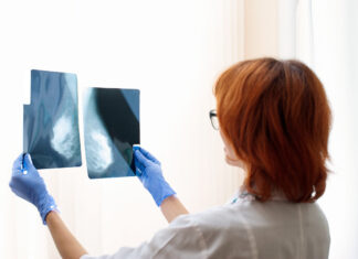 Madrid deriva las mamografías a la privada mientras mantiene mamógrafos cerrados